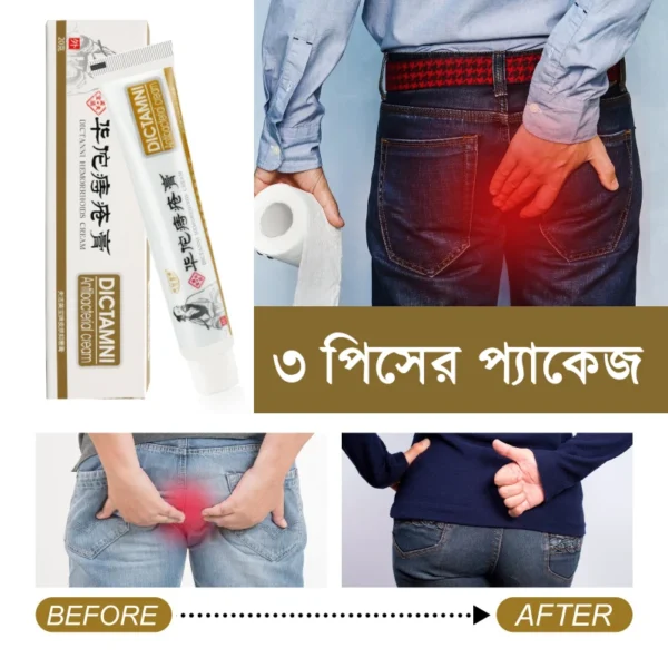 China Dictamni Piles Creams (3 পিস=ফুল কোর্স )
